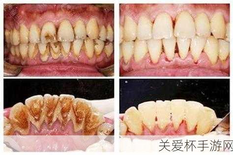 洗牙会把牙齿的牙釉质洗掉吗蚂蚁庄园今日答案早知道 9 ，洗牙真相大揭秘